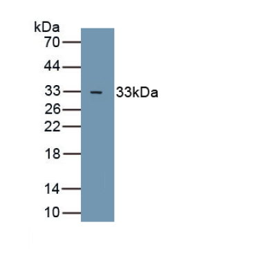 Glycogen Synthase Kinase 3 Beta (GSK3b) Human Polyclonal Antibody