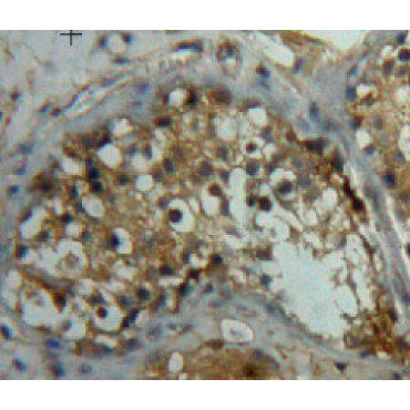 Left/Right Determination Factor 2 (LEFTY2) Human Polyclonal Antibody