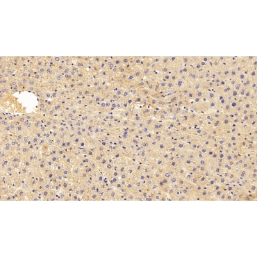 Aldolase B, Fructose Bisphosphate (ALDOB) Human Polyclonal Antibody