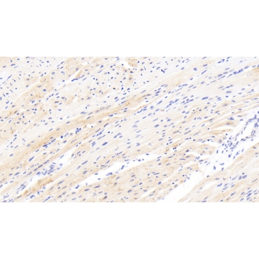 Calcium/Calmodulin Dependent Protein Kinase II Beta (CAMK2b) Human Polyclonal Antibody