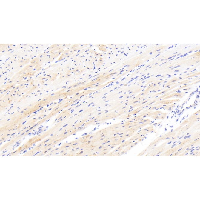 Calcium/Calmodulin Dependent Protein Kinase II Beta (CAMK2b) Human Polyclonal Antibody