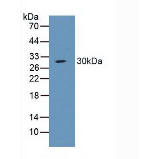 Amiloride Sensitive Sodium Channel Subunit Alpha (SCNN1a) Human Polyclonal Antibody