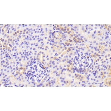Amiloride Sensitive Sodium Channel Subunit Alpha (SCNN1a) Mouse Polyclonal Antibody
