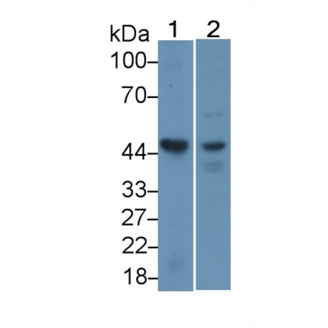 Casein Kinase 1 Delta (CSNK1d) Human Polyclonal Antibody