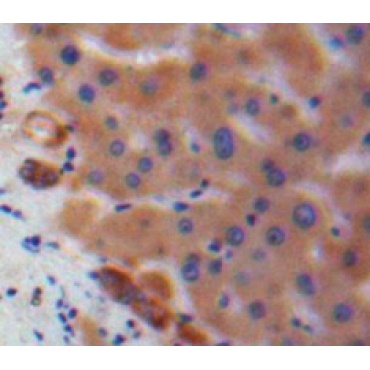 Interleukin 17C (IL17C) Human Polyclonal Antibody