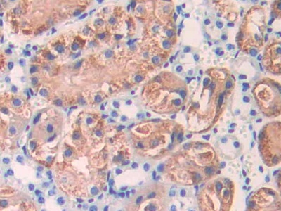 Interleukin 17 Receptor E (IL17RE) Mouse Polyclonal Antibody