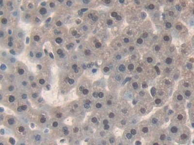 Interleukin 17 Receptor D (IL17RD) Rat Polyclonal Antibody