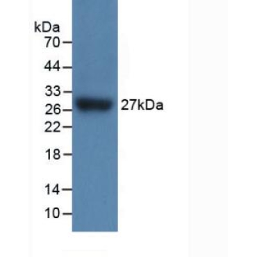 Interleukin 17 Receptor C (IL17RC) Mouse Polyclonal Antibody