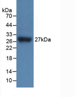 Interleukin 17 Receptor C (IL17RC) Mouse Polyclonal Antibody