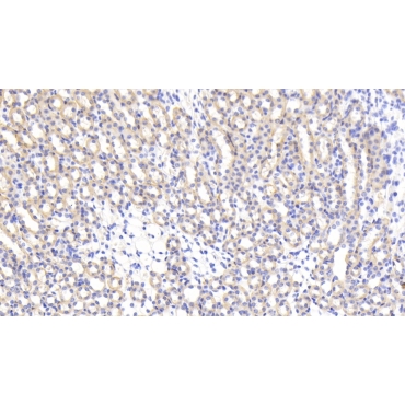 Interleukin 17 Receptor B (IL17RB) Mouse Polyclonal Antibody
