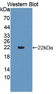 Slit Homolog 3 (Slit3) Human Polyclonal Antibody