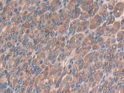Slit Homolog 3 (Slit3) Mouse Polyclonal Antibody