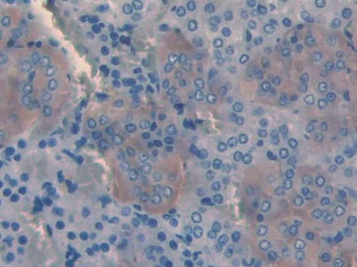 Slit Homolog 3 (Slit3) Rat Polyclonal Antibody