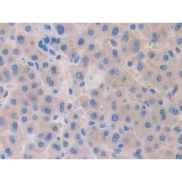 Slit Homolog 1 (Slit1) Human Polyclonal Antibody