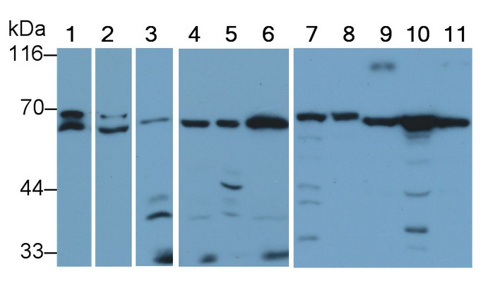 Protein Kinase, AMP Activated Alpha 2 (PRKAa2) Human Polyclonal Antibody