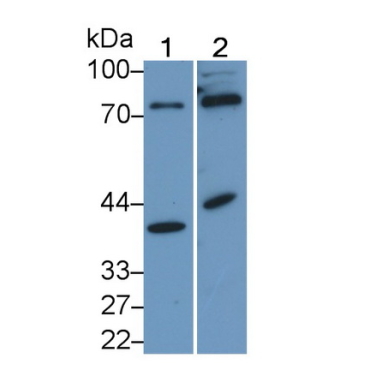 Kruppel Like Factor 15 (KLF15) Human Polyclonal Antibody