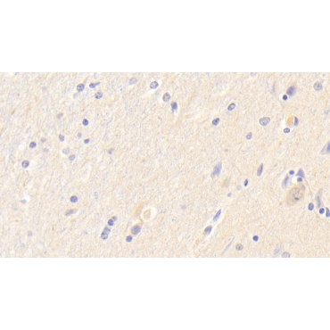 Neuroserpin (NSP) Human Polyclonal Antibody