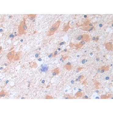 Cytoplasmic Antiproteinase 3 (CAP3) Human Polyclonal Antibody