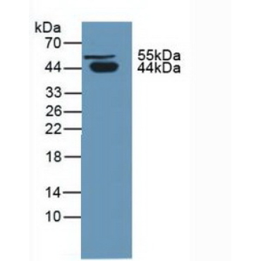Protein C Inhibitor (PCI) Human Polyclonal Antibody