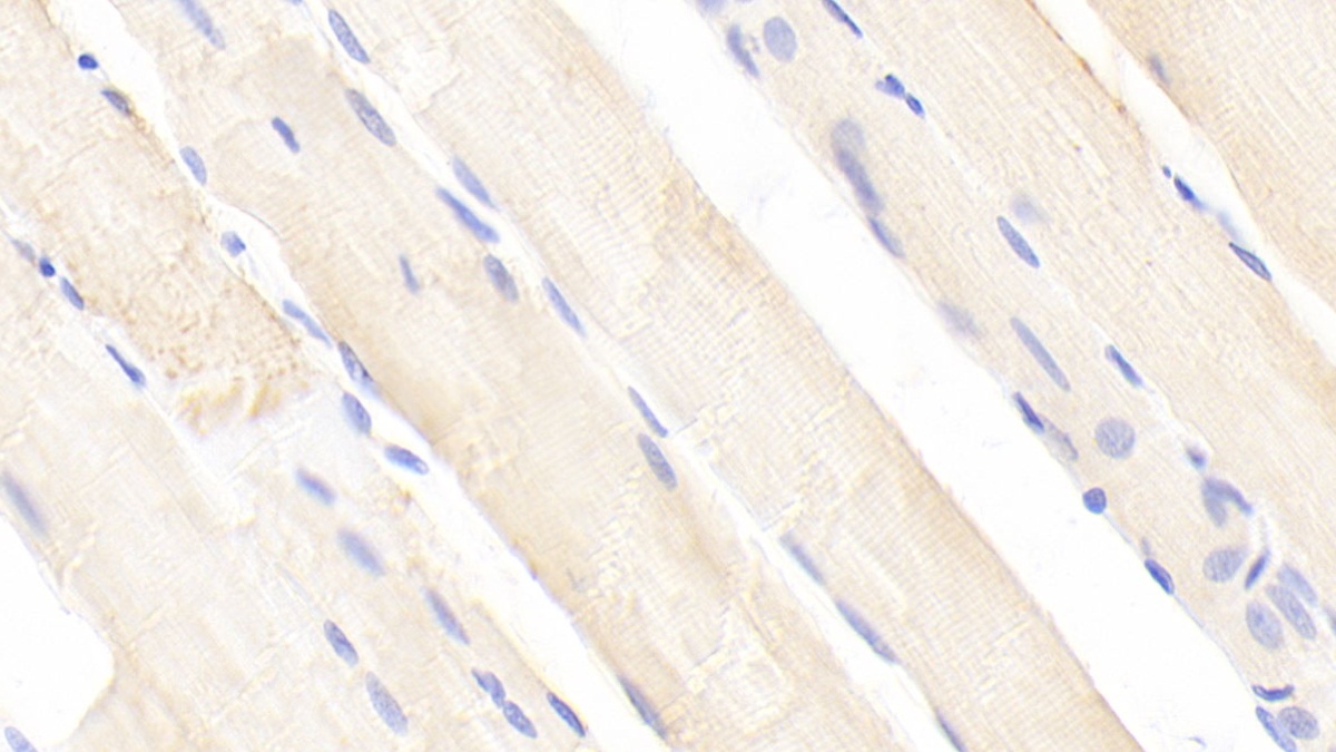 Phosphofructokinase, Liver (PFKL) Rat Polyclonal Antibody