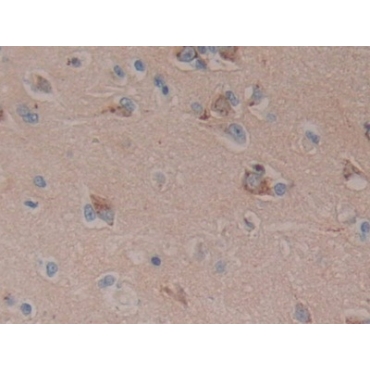Dickkopf Related Protein 3 (DKK3) Human Polyclonal Antibody