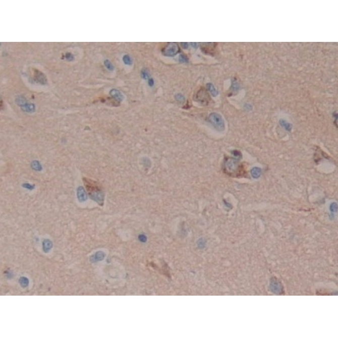 Dickkopf Related Protein 3 (DKK3) Human Polyclonal Antibody