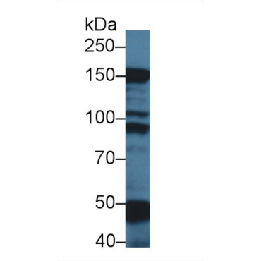 Myosin Binding Protein C, Slow Type (MYBPC1) Mouse Polyclonal Antibody