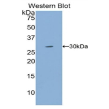 Myosin Heavy Chain 4, Skeletal Muscle (MYH4) Human Polyclonal Antibody