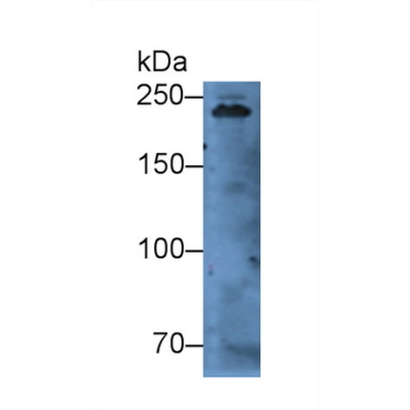 Myosin Heavy Chain 7, Cardiac Muscle, Beta (MYH7) Human Polyclonal Antibody