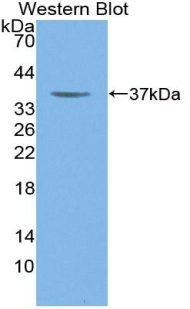 Myosin Heavy Chain 6, Cardiac Muscle, Alpha (MYH6) Rat Polyclonal Antibody