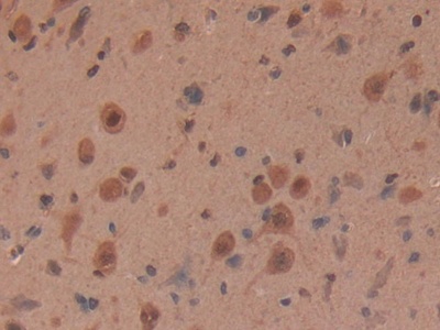 Myosin Heavy Chain 6, Cardiac Muscle, Alpha (MYH6) Rat Polyclonal Antibody