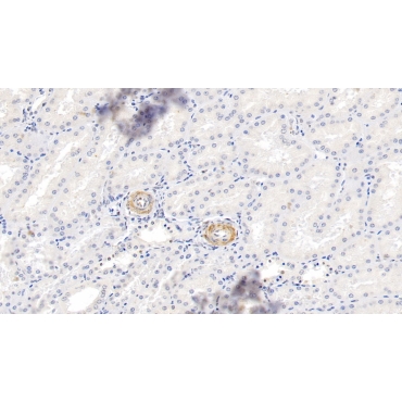 Myosin Heavy Chain 11, Smooth Muscle (MYH11) Human Polyclonal Antibody