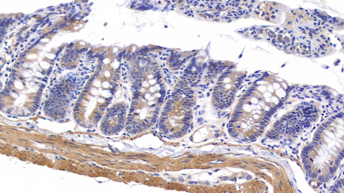 Myosin Heavy Chain 11, Smooth Muscle (MYH11) Rat Polyclonal Antibody
