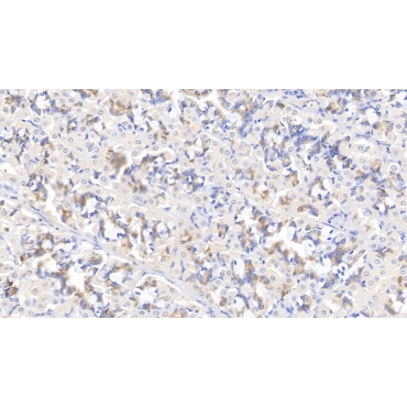 Myosin Heavy Chain 9, Non Muscle (MYH9) Human Polyclonal Antibody