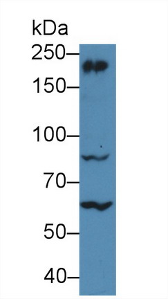 Myosin Heavy Chain 10, Non Muscle (MYH10) Human Polyclonal Antibody