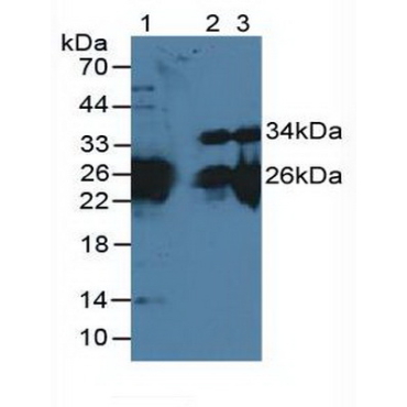 Myosin Light Chain 3, Alkali, Ventricular, Slow Skeletal (MYL3) Mouse Polyclonal Antibody