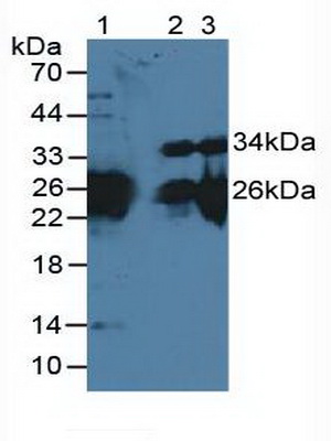 Myosin Light Chain 3, Alkali, Ventricular, Slow Skeletal (MYL3) Mouse Polyclonal Antibody