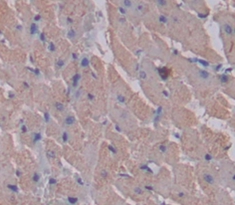 Myosin Light Chain Kinase 2 (MYLK2) Rat Polyclonal Antibody