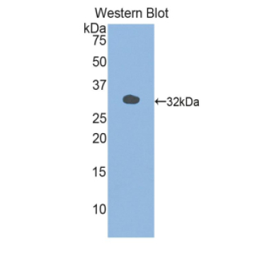 Myosin Light Chain Kinase 3 (MYLK3) Mouse Polyclonal Antibody