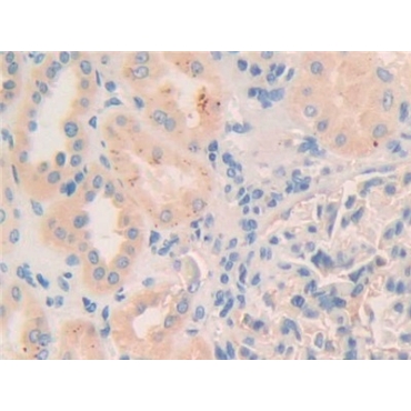 Myosin IC (MYO1C) Human Polyclonal Antibody