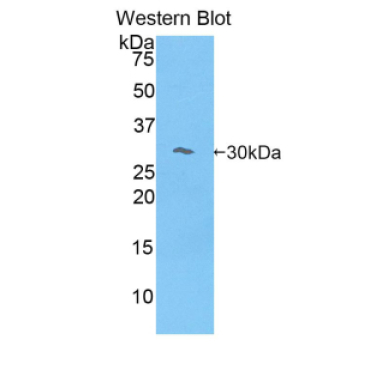 Myosin IE (MYO1E) Human Polyclonal Antibody