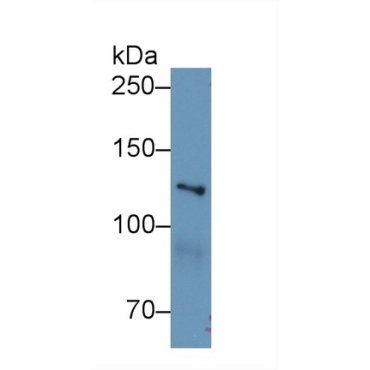 Myosin IE (MYO1E) Mouse Polyclonal Antibody