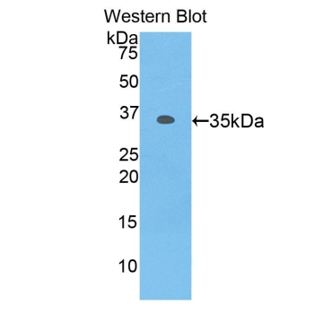 Myosin IF (MYO1F) Human Polyclonal Antibody