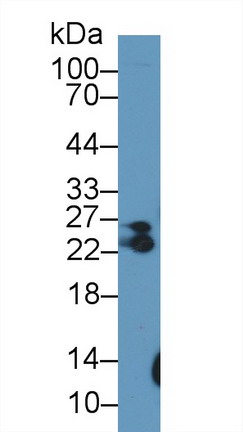 Myosin Light Chain 6B, Alkali, Smooth Muscle And Non Muscle (MYL6B) Human Polyclonal Antibody