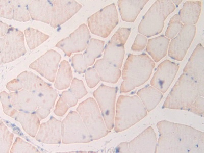 Myosin Light Chain 6B, Alkali, Smooth Muscle And Non Muscle (MYL6B) Rat Polyclonal Antibody