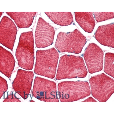 Tropomyosin 2 Beta (TPM2) Human Polyclonal Antibody