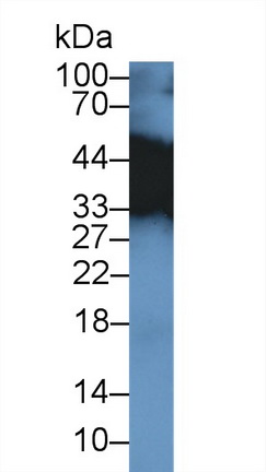 Tropomyosin 3 (TPM3) Mouse Polyclonal Antibody