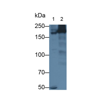 Myosin Heavy Chain 14, Non Muscle (MYH14) Human Polyclonal Antibody