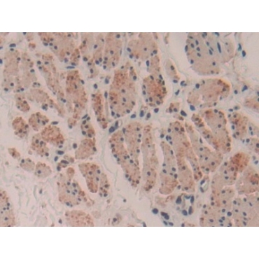 Myosin Heavy Chain 16 (MYH16) Human Polyclonal Antibody