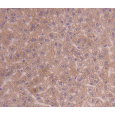 Pyruvate Dehydrogenase Kinase Isozyme 3 (PDK3) Mouse Polyclonal Antibody